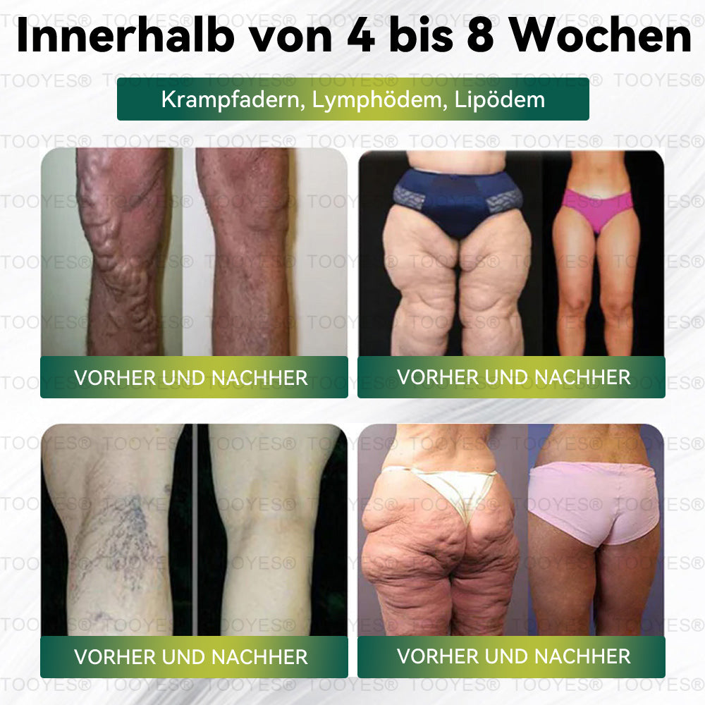 Herzlichen Glückwunsch! Sie sind unser 500. Kunde heute und erhalten ein exklusives Angebot: Das zweite Produkt gibt es mit 30 % Rabatt! TOOYES®